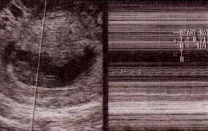 Actividad cardíaca: 9 semanas.