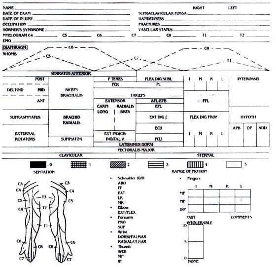 Brachial plexus Brachial plexus