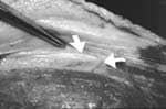 Perforantes de la arteria tibial