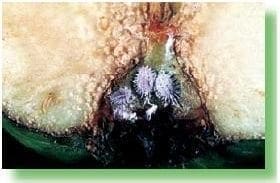 Hembra de un Pseudococcus