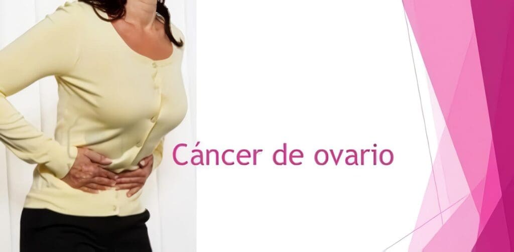 Cáncer de Ovario