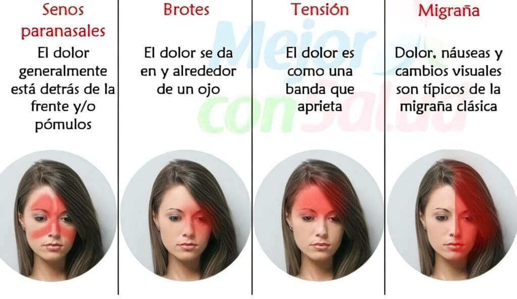 Tratamientos Novedosos alivian el Dolor de la Migraña