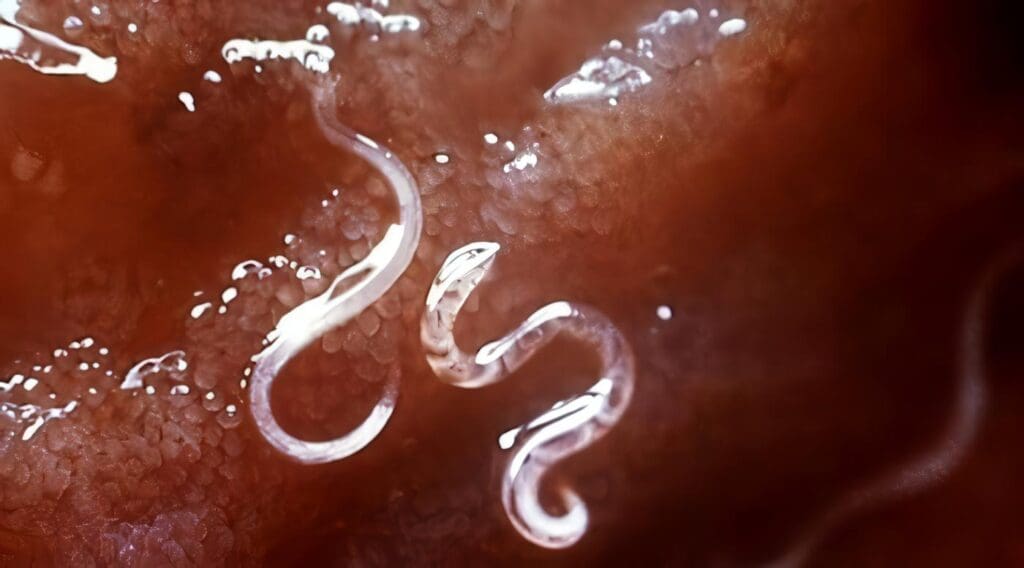 Peligroso Parásito Intestinal