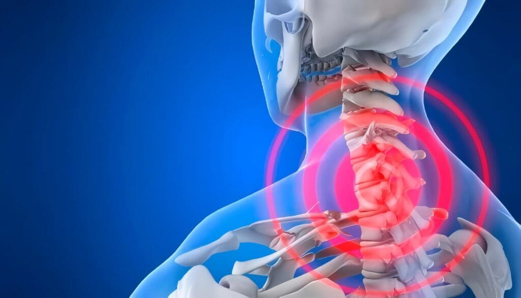 Terapia con Láser parece aliviar el Dolor en el Cuello