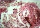 foc5819700pag62-3b