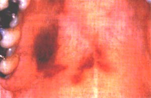 focvol57no19699-57a