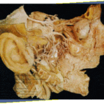 Rehabilitacion-oral-con-enfasis-en-estetica-caso3