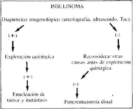 LOCALIZACION y TRATAMIENTO QUIRURGICO DE INSULINOMAS