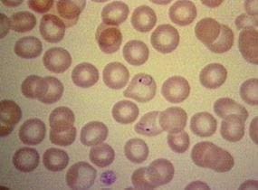 Malaria_prevencion2