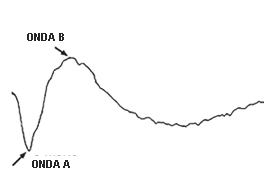 Ten150Laretinaf4