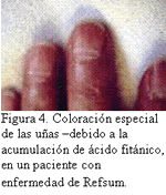Tensiometro115-3