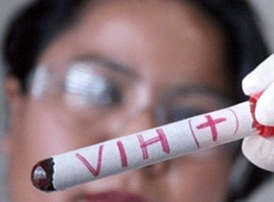 Cantidad de VIH en el Fluido Genital se relaciona con la Transmisión