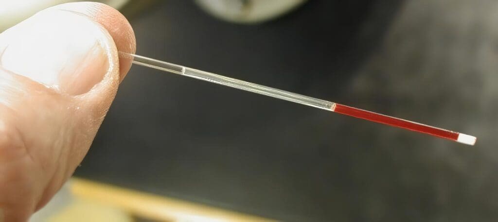 Hematocrito, Marcador de Dengue Hemorrágico
