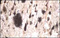 tensiometro36-fig2