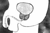 tensiometro9-fig4