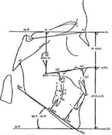 Perfilograma - COGS. Medidas Verticales, esquelético-dentales