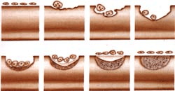 Secuencia de remodelación del hueso trabecular.
