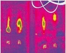 Activación molecular - Electroforesis del Extracto de Alfalfa