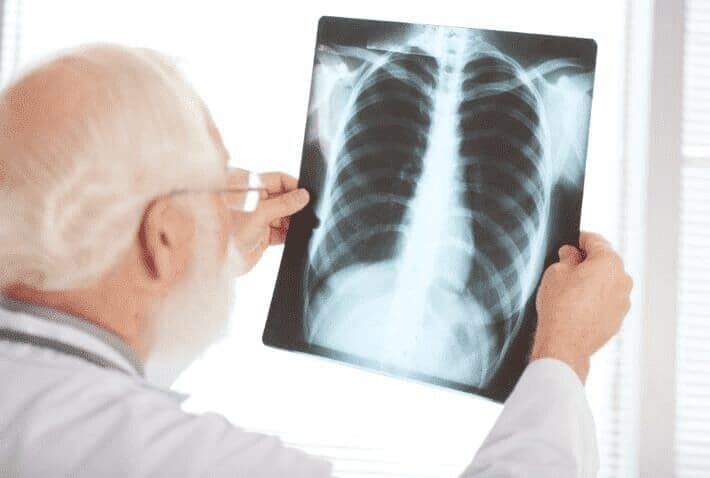 Tuberculosis congénita. Caso clínico