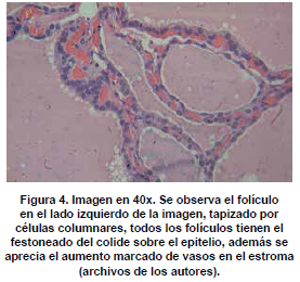 Tapizado de células columnares 