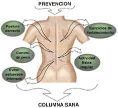Columna sana