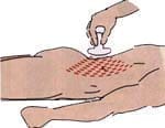 Manejo del dolor