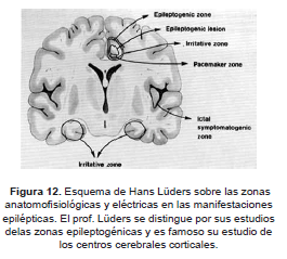 Esquema de Hans Lüders