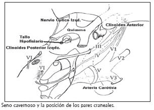 Seno cavernoso