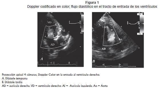 Doppler codificado