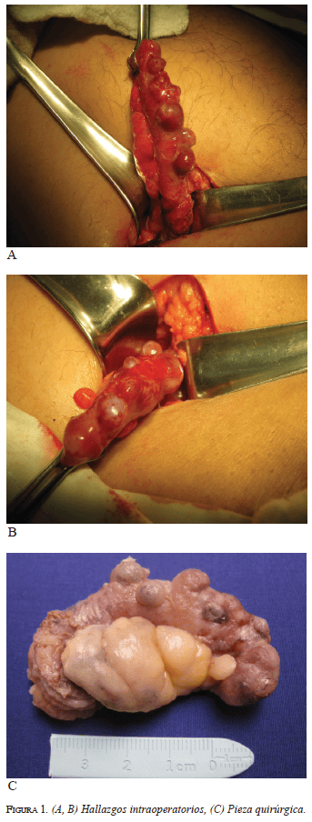 figura1Hallazgos-intraoperatorios