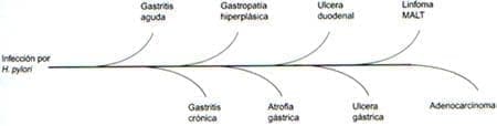 Patologías asociadas a la infección H.pylori Patologías asociadas a la infección H.pylori