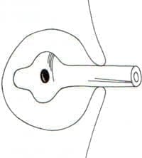 Sonda de drenaje