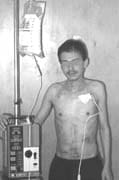Nutrición parenteral total