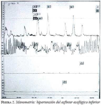 figura2manometria