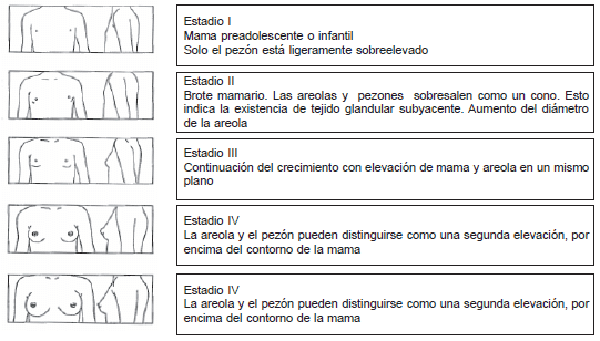 Desarrollo mamario Tanner en niñas
