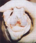 Anatomia microscopica clavija osea 6 semanas