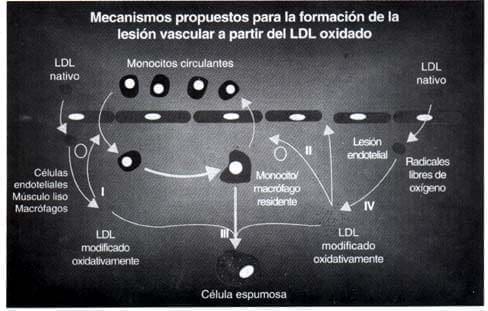 Mecanismos para la formación de lesión vascular Mecanismos para la formación de lesión vascular