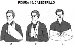 Vendaje tipo Cabestrillo Vendaje tipo Cabestrillo