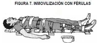 Inmovilización con Férulas Inmovilización con Férulas