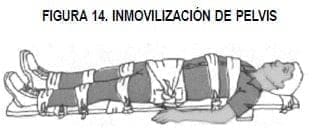 Inmovilización de pelvis Inmovilización de pelvis