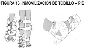Inmovilización de tobillo y pie Inmovilización de tobillo y pie
