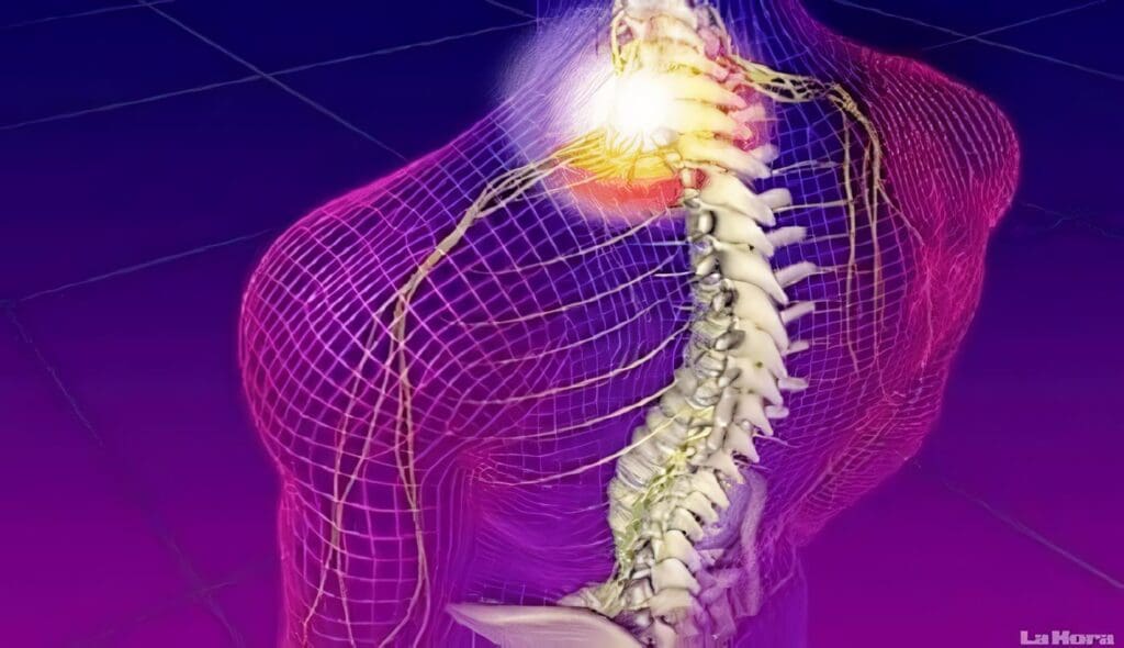 Trauma Raquimedular