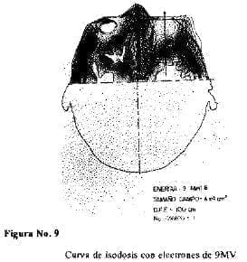 Curva isodosis Curva isodosis