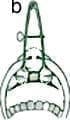 Hipofisectomía Transesfenoidal, Especulo nasal