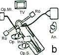  Cirugía Transesfenoidal.