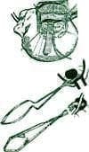 Craneotomía para exclusión de Aneurisma Cerebral con Gancho Metálico