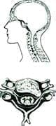Hernia discal cervical