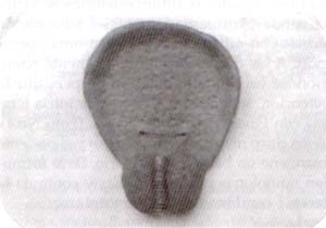 Verumontanum