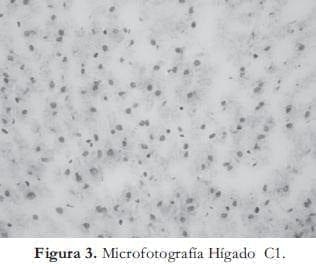 Microfotografia Hígado