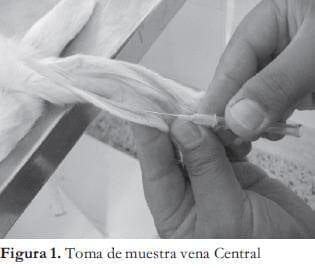 Toma de muestra vena central